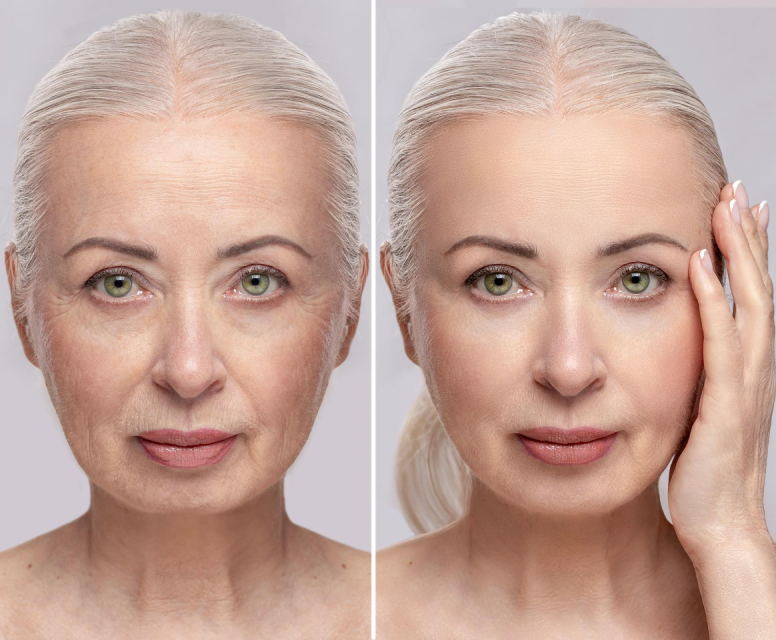 before-after